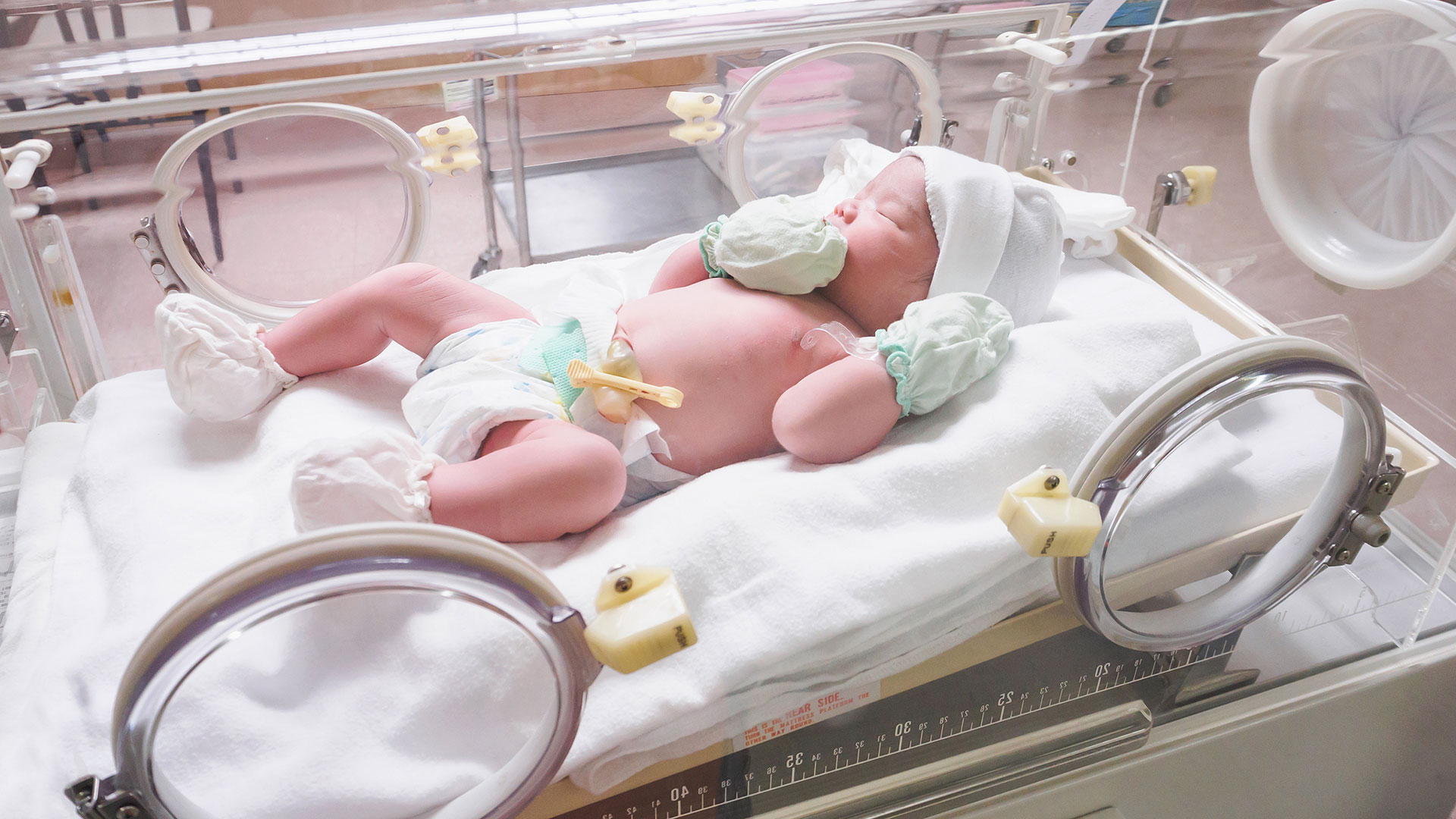 Preventable Disabilities: How Neonatal Care Can Prevent Severe Neurological Sequelae